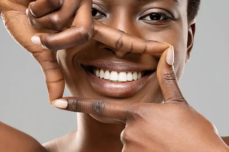 Réflexion sur les options esthétiques pour le sourire